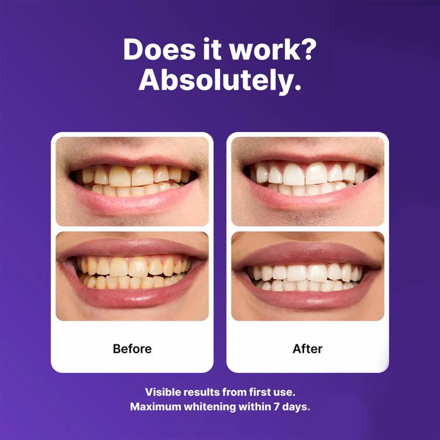 OraClear Purple Whitening Strips