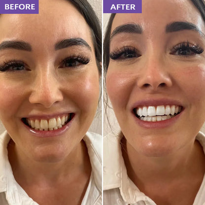 OraClear Purple Whitening Strips