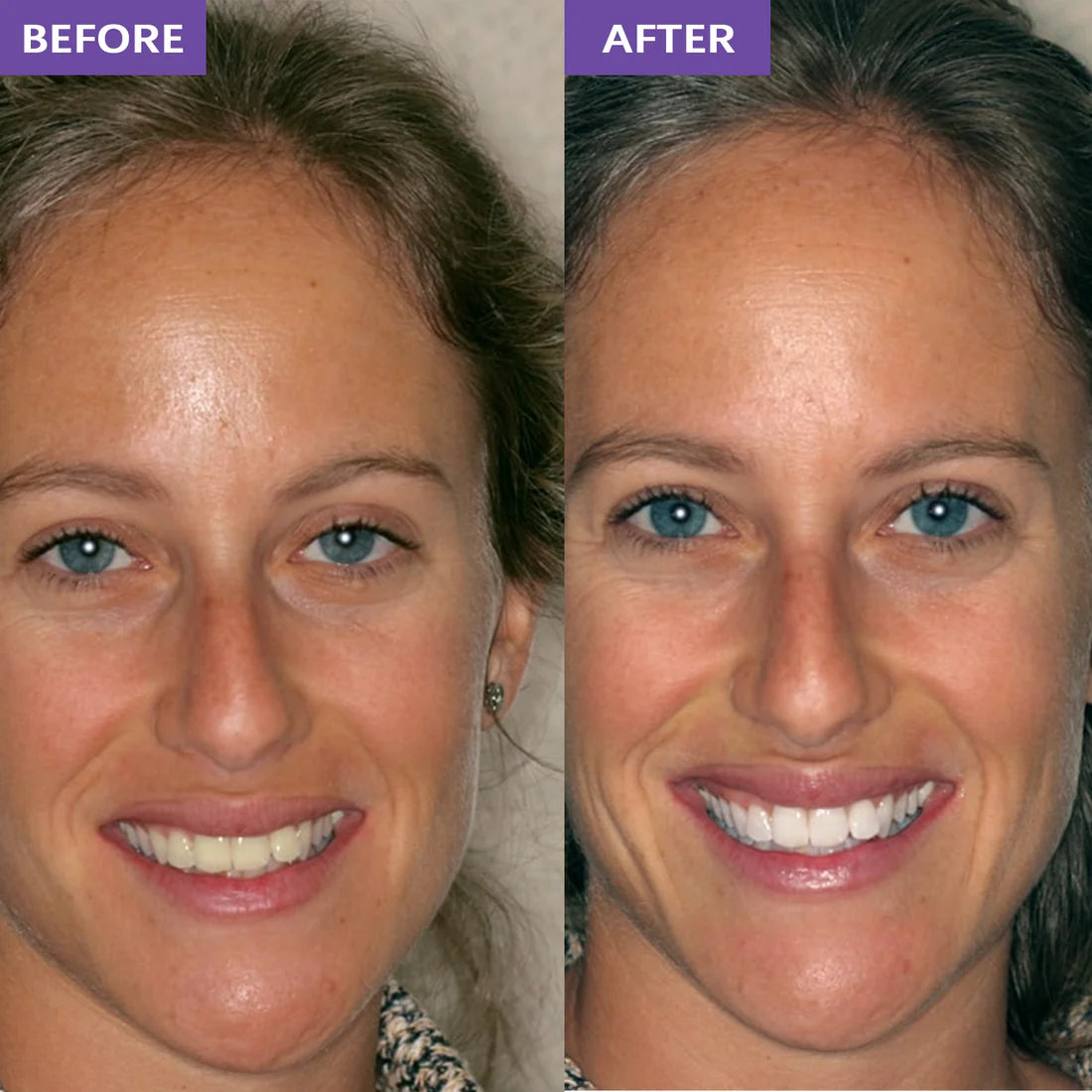 OraClear Purple Whitening Strips