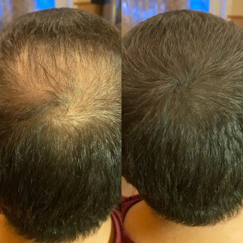 Élevé Hair Camouflage