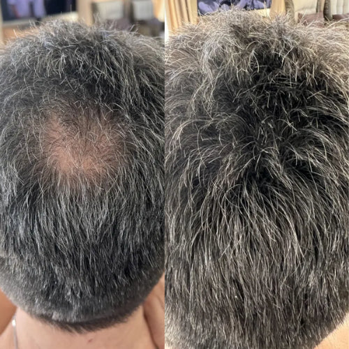 Élevé Hair Camouflage